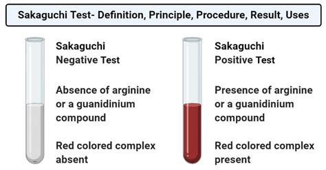 sakaguchi test|Sakaguchi test: Objective, Principle, Reagents, .